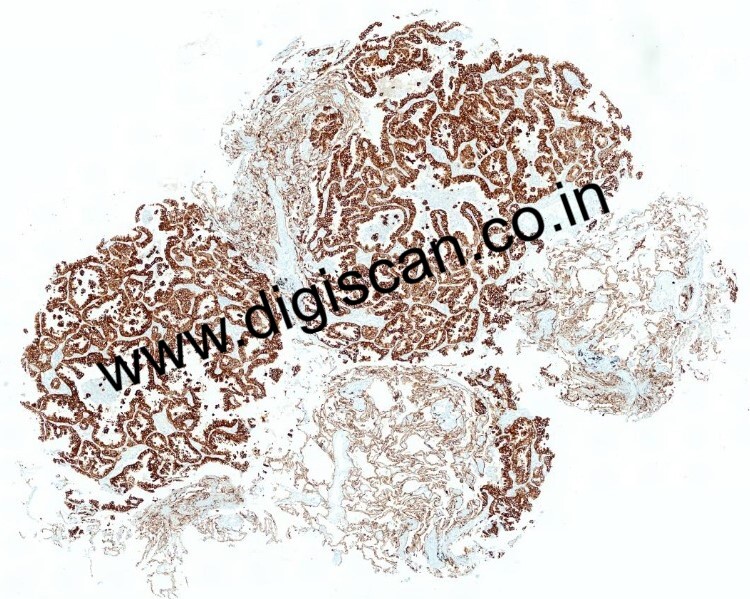 Immunohistochemistry Digital Slides Set (IHC Markers & Cases)